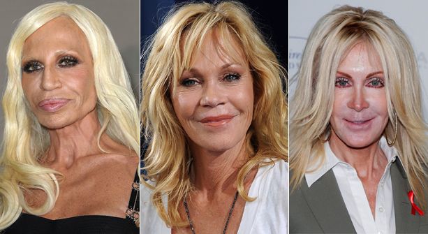 10 famosos adictos al bisturí