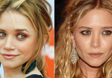 8 celebs que se veían mejor antes de las cirugías