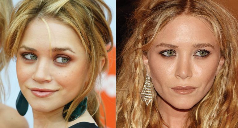 8 celebs que se veían mejor antes de las cirugías