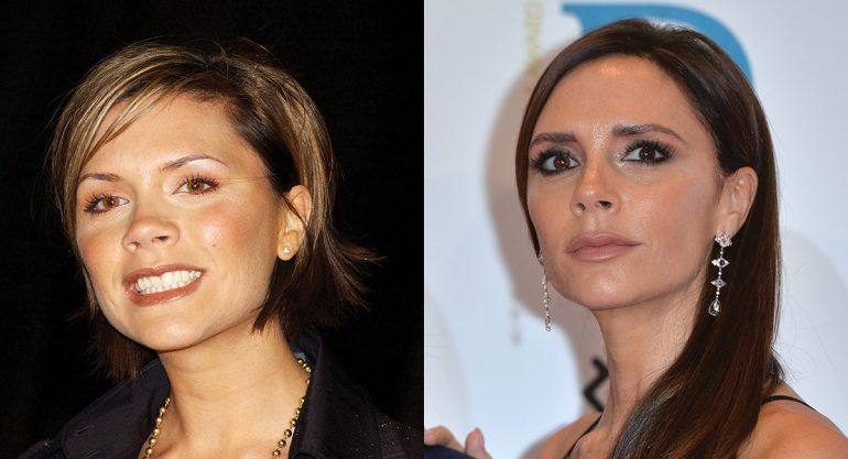 Antes y después del matrimonio