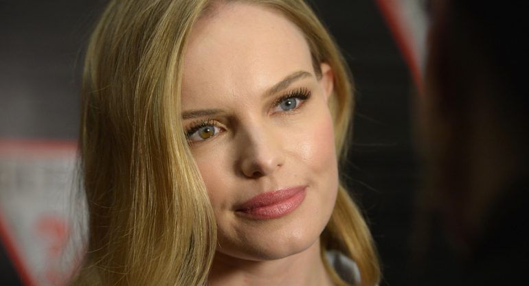 Celebs con ojos de diferente color