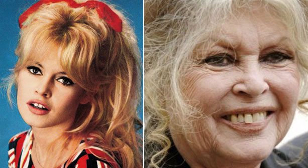 Famosas que no envejecieron bien